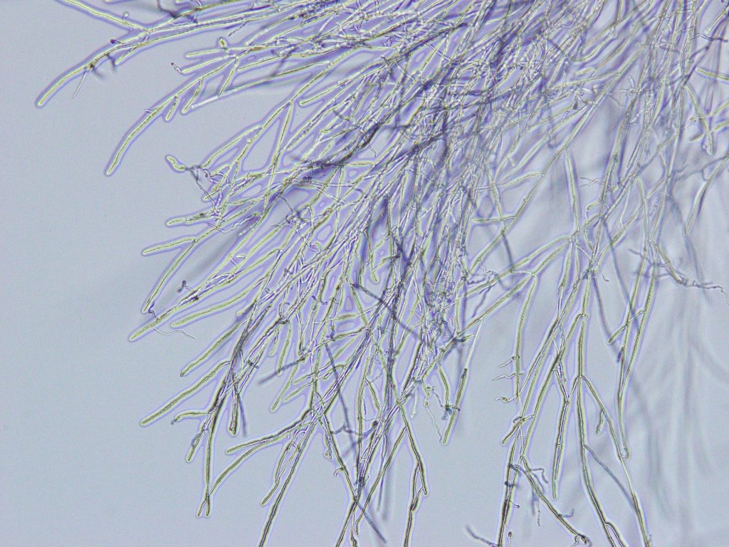アガリクスの菌糸体 タンク培養 と子実体の比較 違い 動画あり アガリクス研究no 1東栄新薬株式会社